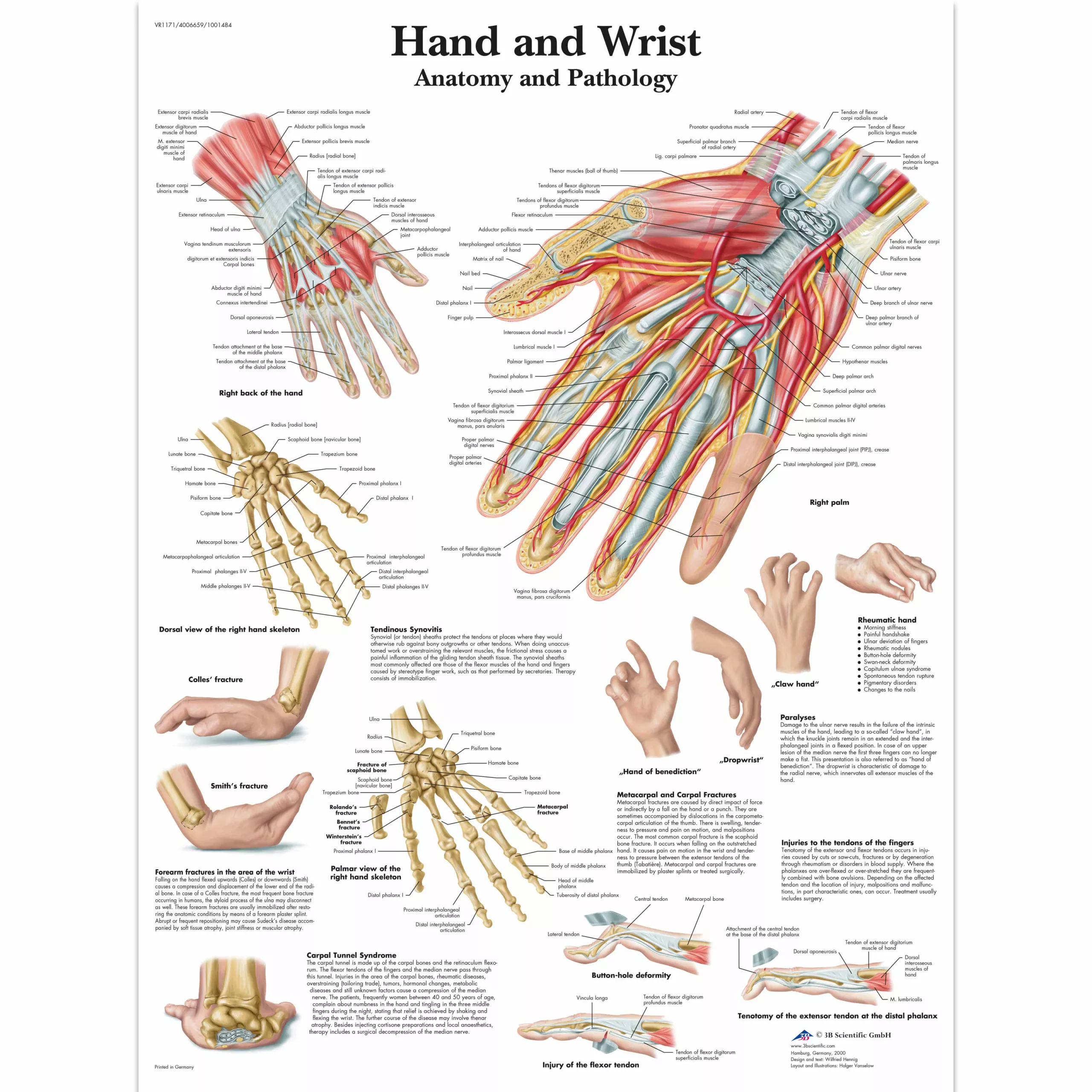 Anatomical Chart – hand & wrist sticky back